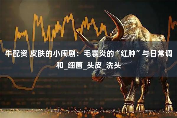 牛配资 皮肤的小闹剧：毛囊炎的“红肿”与日常调和_细菌_头皮_洗头